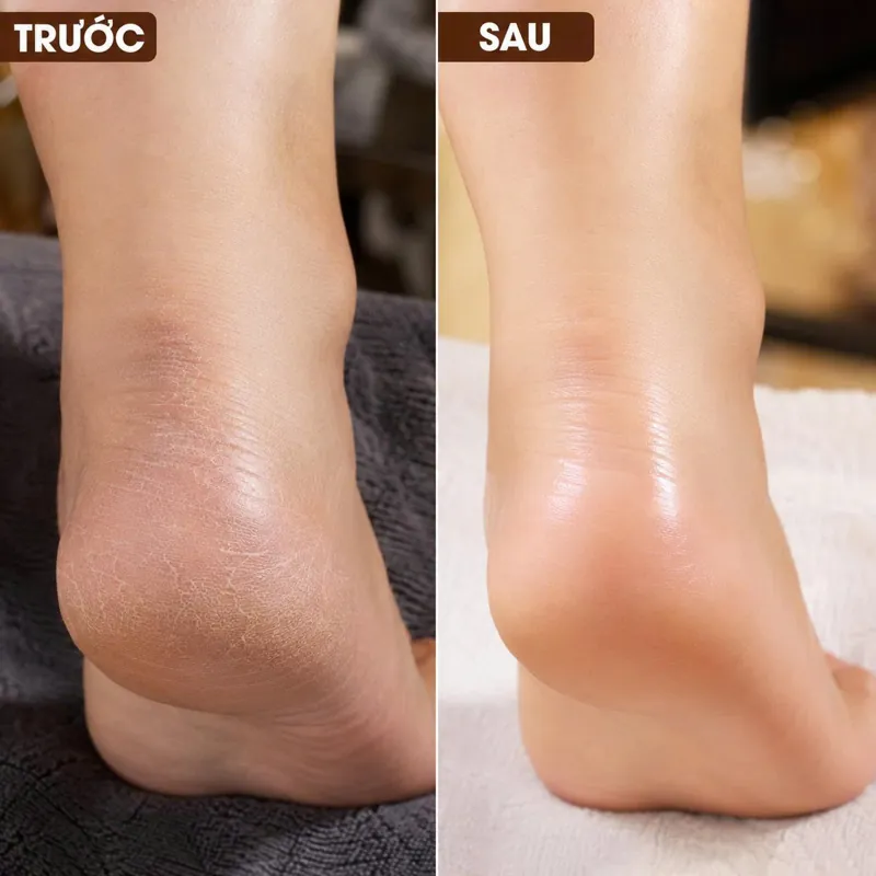 Da chân mềm mịn liền tay